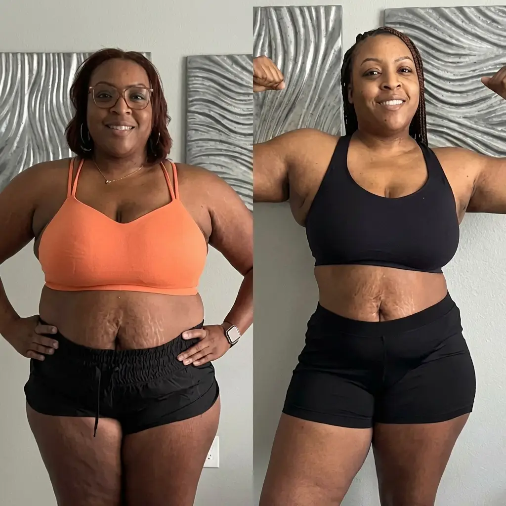 Precision Telemed | Compounded Semaglutide Patient transformation result — significant weight loss with Semaglutide
